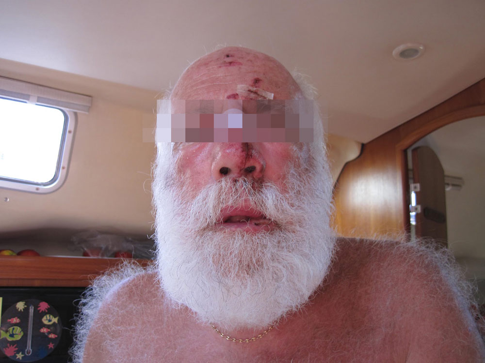 pere-noel-victime-racisme-agression "Rentre en Laponie, ici on n'aime pas les barbus !" : Le Père Noël victime d'une violente agression raciste