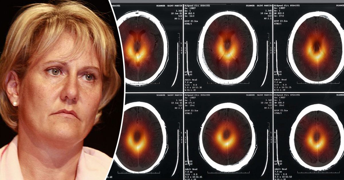 La science s'excuse : le trou noir n'était que le scanner cérébral de Nadine Morano