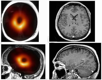 cerveau-trou-noir La science s'excuse : le trou noir n'était que le scanner cérébral de Nadine Morano